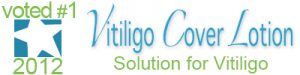 best-solution-for-vitiligo