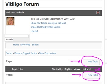 vitiligo forum-1