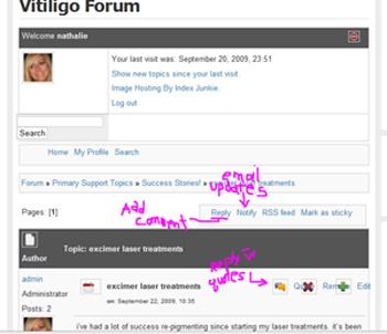 vitiligo forum-3