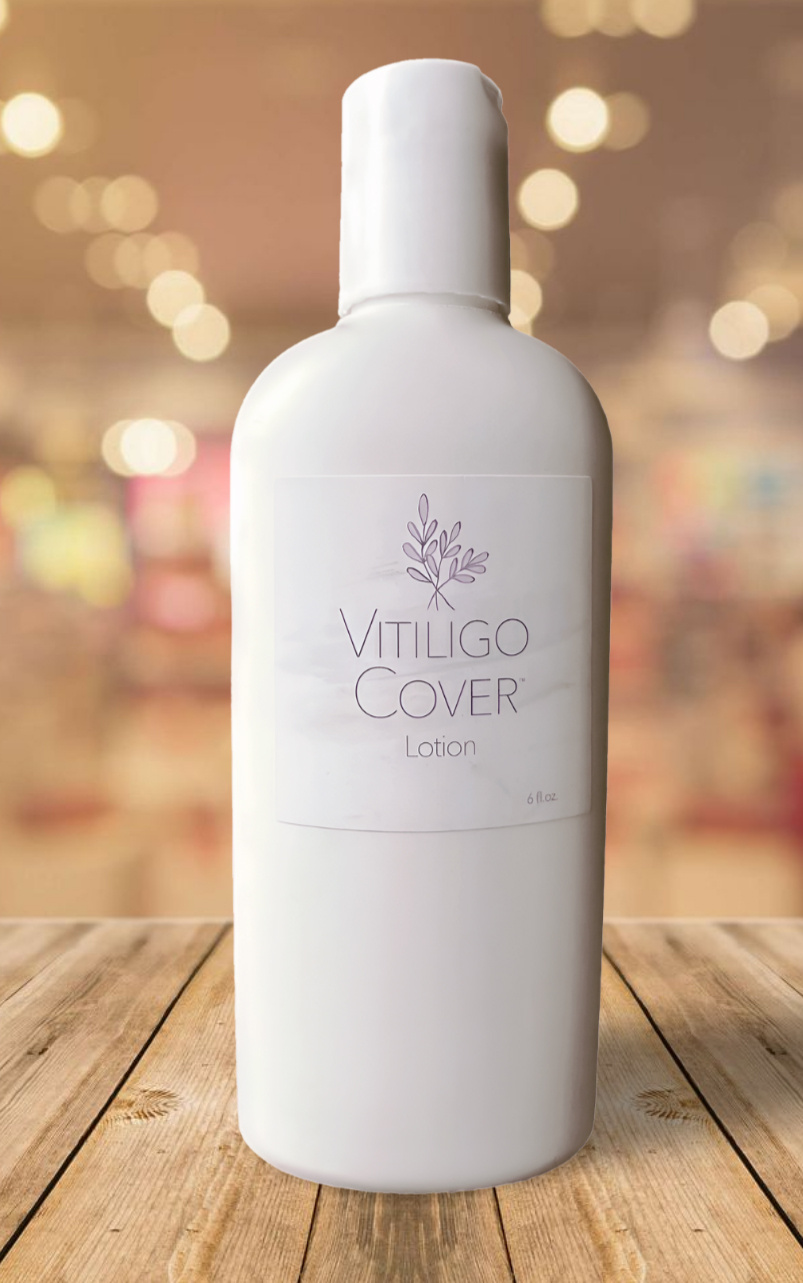 6 oz Vitiligo • Vitiligo Cover