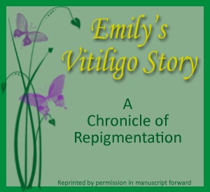 emilys-vitiligo