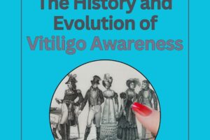 history awareness vitiligo