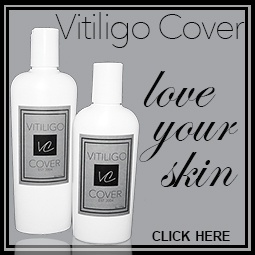 cover vitiligo